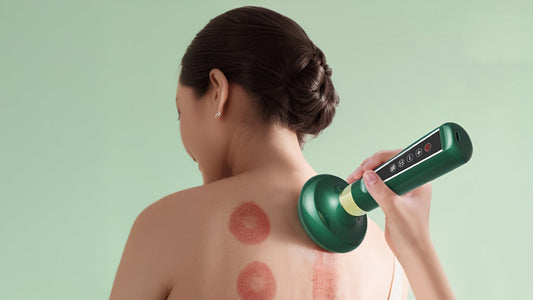 Smart Infrared Cupping Therapy