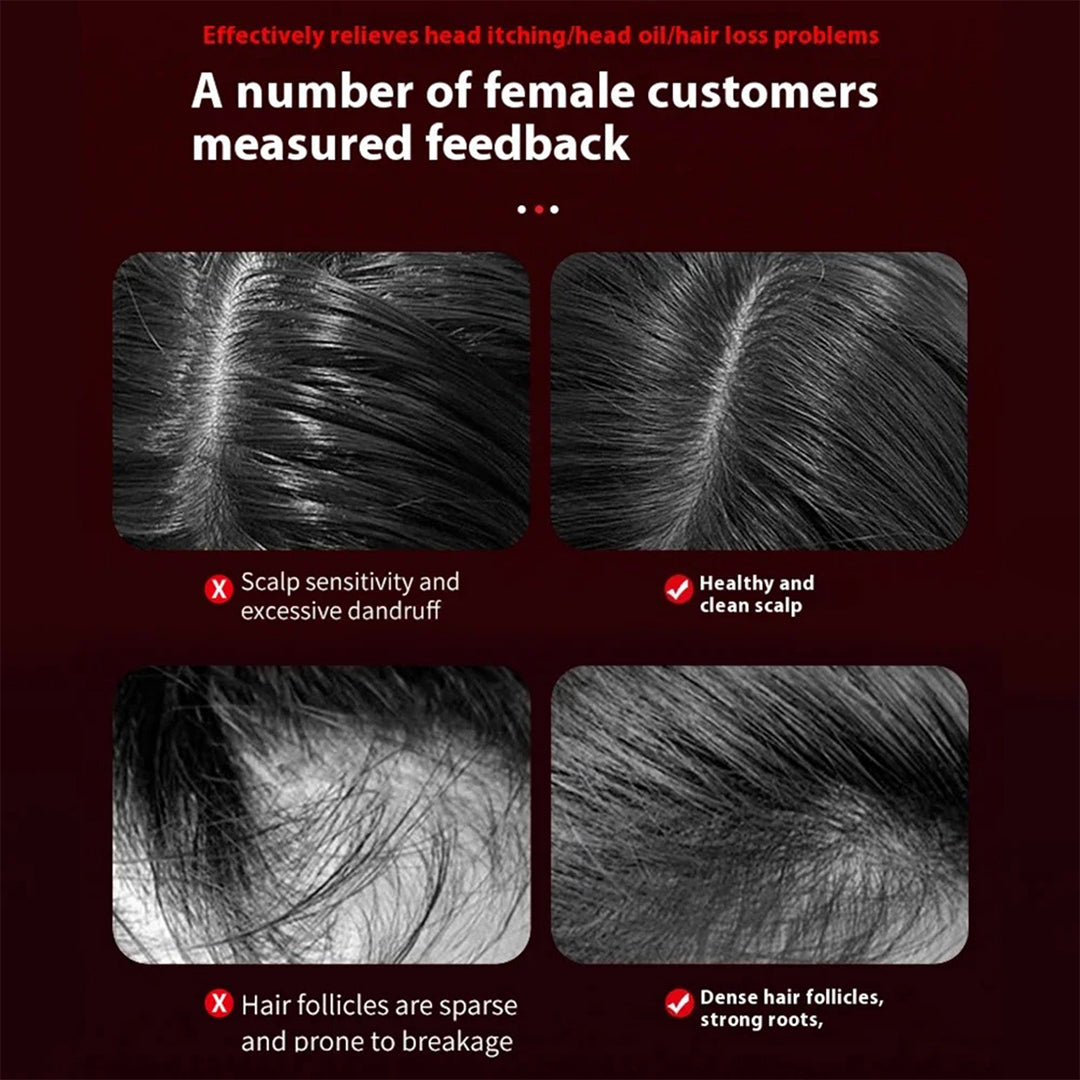 FIVOX LumiScalp™ – Infrared Oil Comb & Scalp Massager